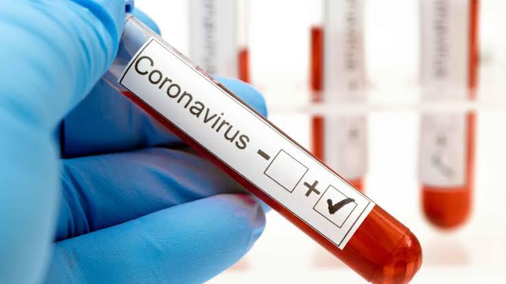 Escalan en Nuevo Lardo contagios y decesos por Covid-19