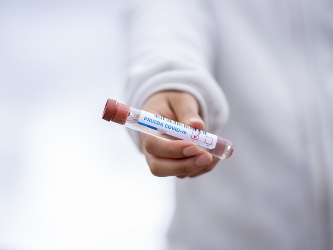 Alemania dona 100 mil pruebas de coronavirus a Perú
