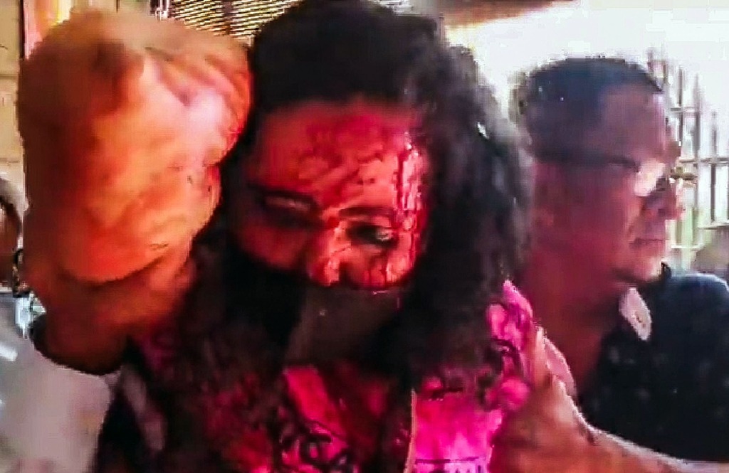 Pleito entre sandinistas y opositores deja a periodista herida a pedradas en Nicaragua