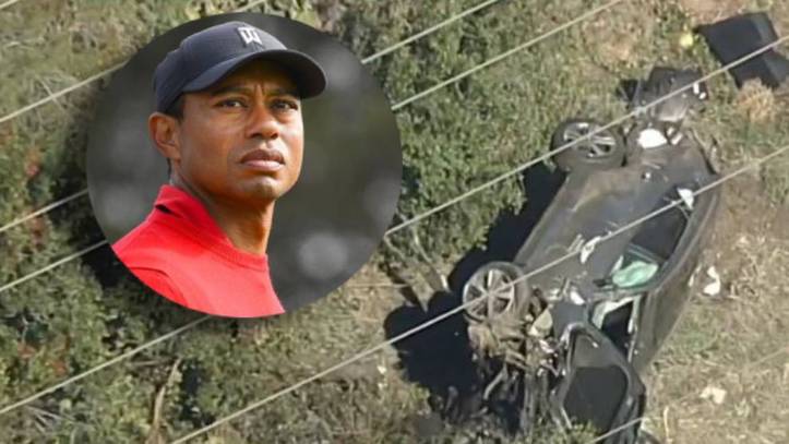 El astro del golf Tiger Woods sufre accidente y tiene múltiples lesiones en las piernas