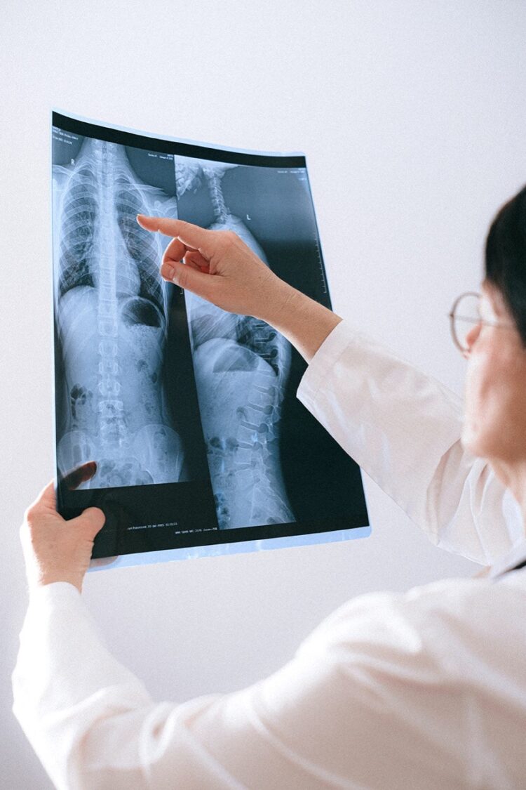 Refuerza el ISSSTE prevención contra tuberculosis pulmonar durante la pandemia