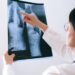 Refuerza el ISSSTE prevención contra tuberculosis pulmonar durante la pandemia